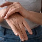 Release - Síndrome de Raynaud - Crédito - ShutterStock - Faculdade Santa Marcelina