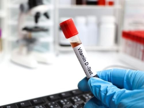 0a9ecb35-0f90-d8de-3127-719c54e01b64